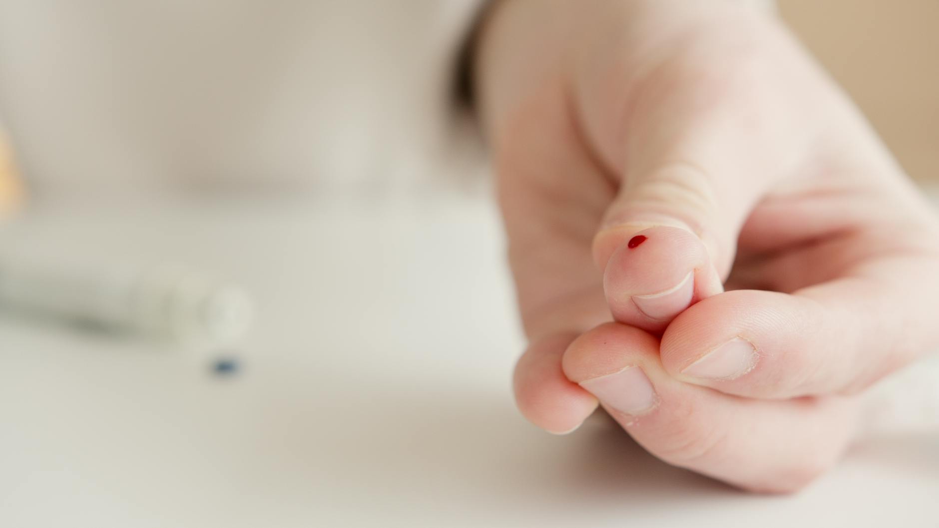 Why Eczema Diagnosis and Treatment Differ Across Skin Tones